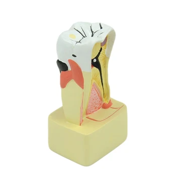 Dantų Dantų Periodonto Ligų Modelio Analizė Patologijos Modelis Dantų Mokymo, mokslinių Tyrimų Modelį, Stomatologas Studens Tyrimas