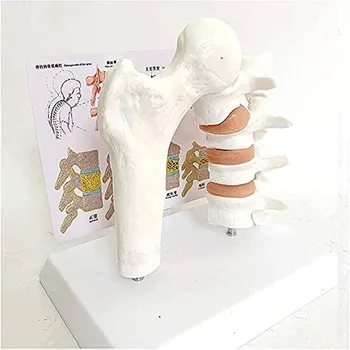 Žmogaus Šlaunikaulio Osteoporozės Patologija Juosmeninės Stuburo Skyriuje Anatomijos Modelis, Mokslas, Mokymo Demonstravimo